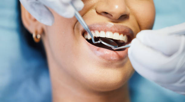 Best Emergency Broken Tooth Repair in Sioux Center, IA